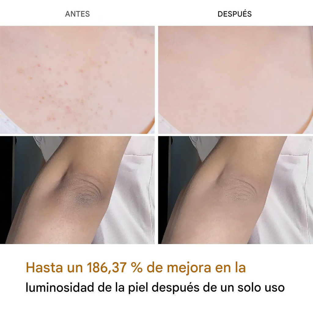 💛OFERTA ESPECIAL! - EXFOLIANTE MELAXIN🌿DILE ADIÓS A LAS ZONAS OSCURAS!✨